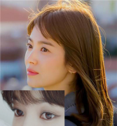 你和女神的雙眼皮到底有什么不一樣