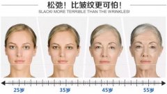 激光祛斑、除皺抗衰老的果怎么樣呢？