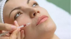 一支玻尿酸需要多少錢？