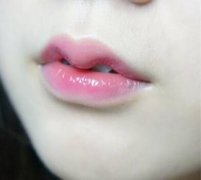 M唇微笑唇的整形手術(shù)介紹和價(jià)格！