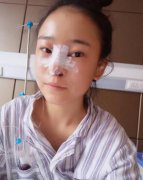 在石家莊做的綜合隆鼻是一種怎樣的體驗呢？