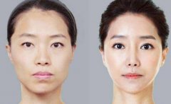 豐蘋果肌的果主要有哪些呢？