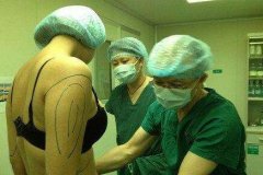 整形的禁區(qū)：哪些部位不能吸脂呢？