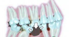 你的牙齒會(huì)讓你微笑起來(lái)難堪嗎