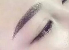 掉痂沒(méi)顏色，是沒(méi)有做好？