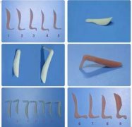 隆鼻假體取出后，鼻梁會(huì)變形嗎？