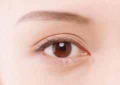 九江做開(kāi)眼角要多少費(fèi)用