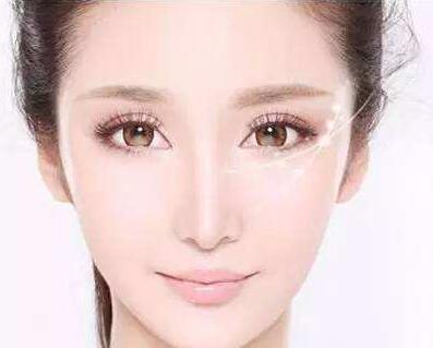 成都美容微針多少錢(qián)?