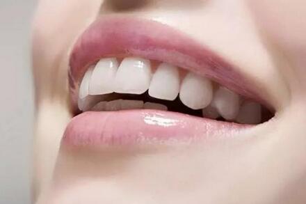 成都華西矯正牙齒需要多少錢