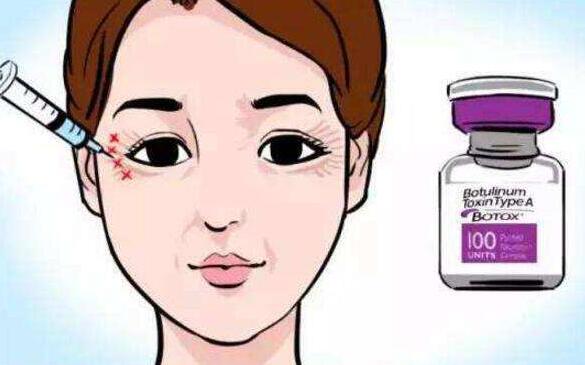 魚尾紋祛除方法