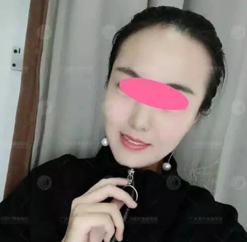 術(shù)后三個(gè)月果圖