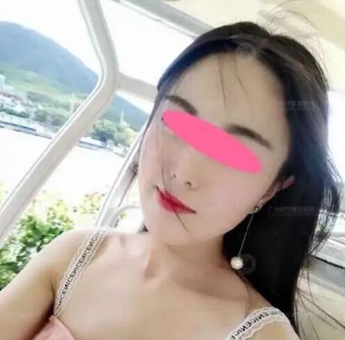 術(shù)后果照片