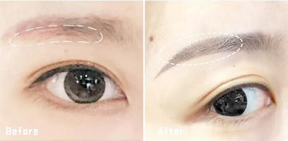 甘肅瑞麗陽光半******紋眉對比圖