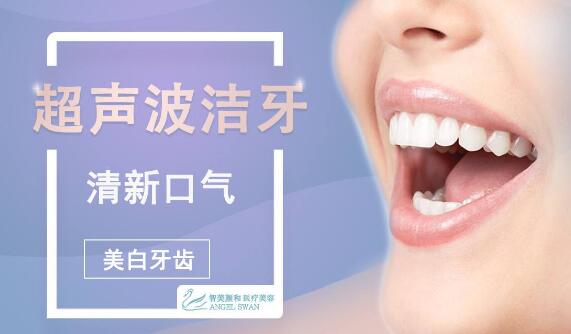 超聲潔牙