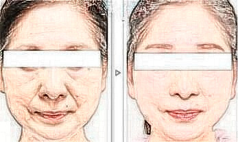 擅長(zhǎng)整形項(xiàng)目