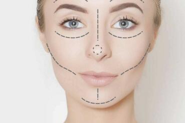 自己注射隆鼻沒問題嗎？為了美，居然有人命都可以不要了？！