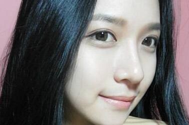 膨體隆鼻假體晃動(dòng)是做失敗了嗎？你出現(xiàn)過這個(gè)問題嗎？