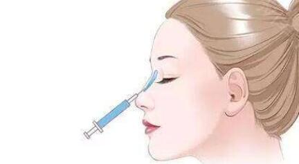 注射隆鼻有副作用嗎?沒問(wèn)題性高嗎?