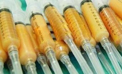 關于自體脂肪填充的一些疑問解答