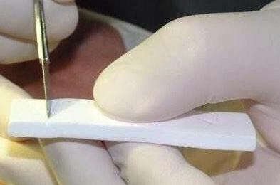 不同的隆鼻方式適合不同鼻部基礎(chǔ)的人群