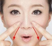 法令紋自體脂肪可以填充嗎？這個技術(shù)好嗎？