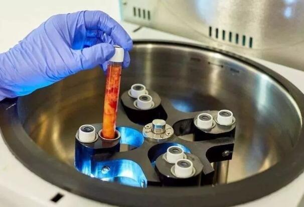 那自體脂肪填充法令紋手術(shù)具體是怎么操作的呢?