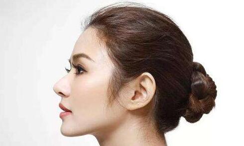 膨體隆鼻假體取出后對(duì)比差別會(huì)不會(huì)很大？