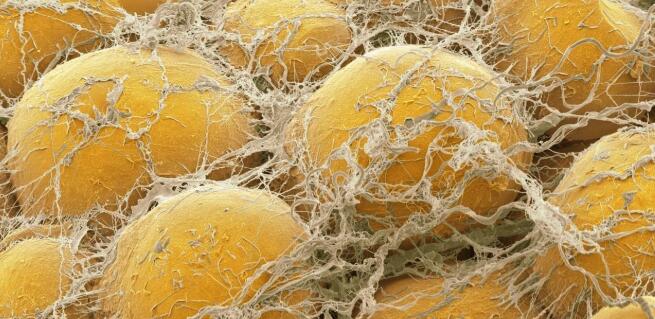 自體脂肪填充注射有沒有抵觸反應?