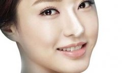 脂肪隆鼻術(shù)的果是怎樣的？術(shù)后可以戴眼鏡嗎