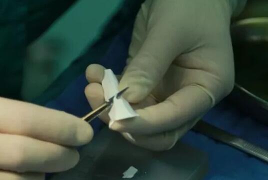 膨體隆鼻簡單介紹