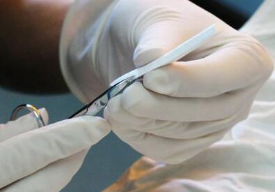 隆鼻假體材料選硅膠好還是膨體好?