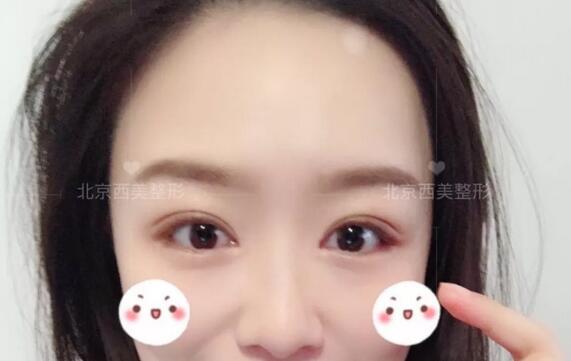 平扇形的雙眼皮，可以給人很嫵媚的感覺(jué)，也可以看起來(lái)很可愛(ài)