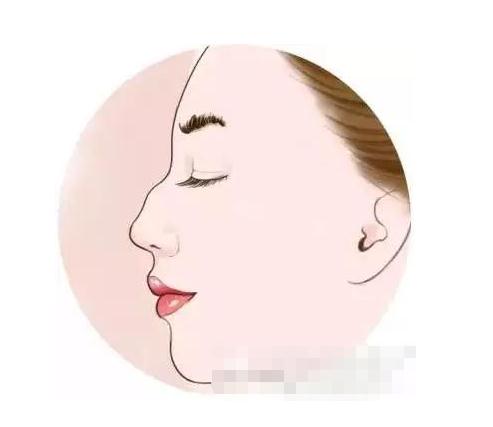 2019年駝峰鼻矯正價錢！收費詳情！