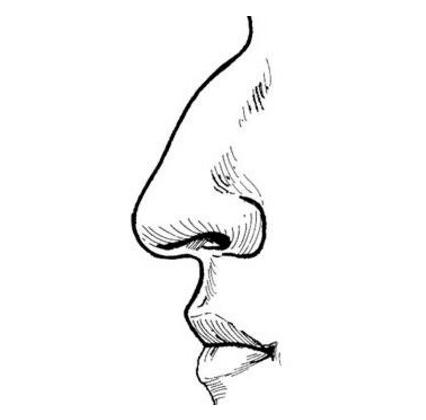 駝峰鼻矯正要多少錢與與選擇的醫(yī)院有關