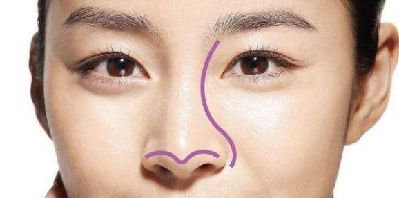 鼻尖成形術的優(yōu)點：