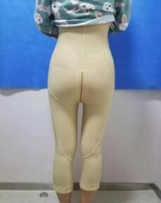 大腿吸脂手術都有以下優(yōu)勢：