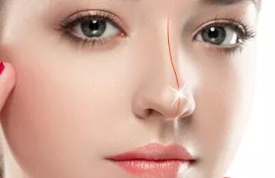 鼻尖成形術的優(yōu)點：