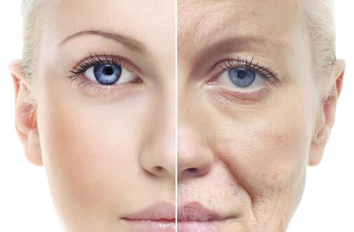 內(nèi)窺鏡除皺術(shù)的優(yōu)點(diǎn)