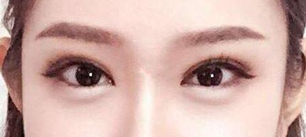 繡眉后的注意事項(xiàng)