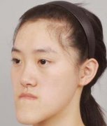 let美人！郭方圓整容前后的變化看了后你有啥感