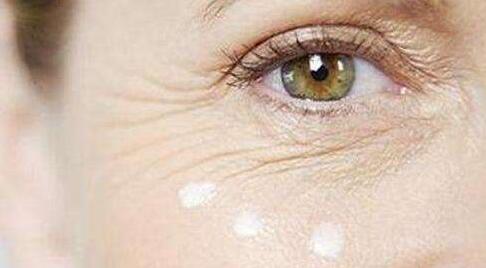 去魚尾紋多少錢？去魚尾紋的方法有哪些？