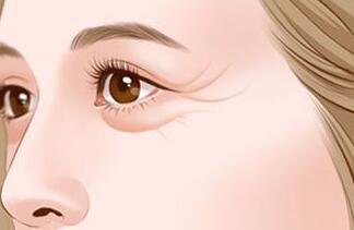 去魚尾紋的方法有哪些？