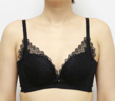 做隆胸蹭上優(yōu)惠活動！術(shù)后真的變成了「大胸弟」！