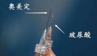 注射奧美定之后有什么癥狀?