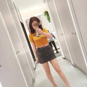 大腿吸脂手術(shù)術(shù)后兩個(gè)月