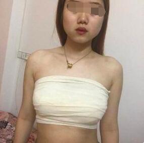 隆胸手術(shù)術(shù)后第6天