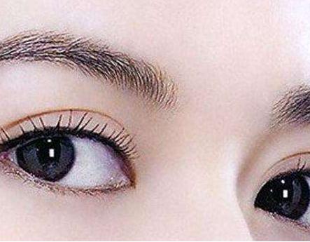 韓式三點式雙眼皮的優(yōu)點