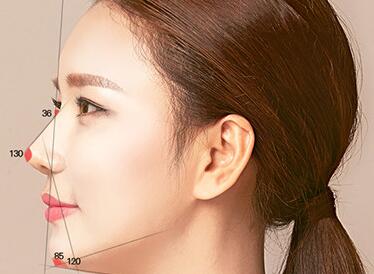 自體脂肪填充隆鼻的手術(shù)過(guò)程