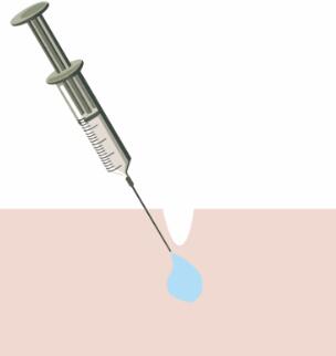 玻尿酸美容的原理是什么呢?