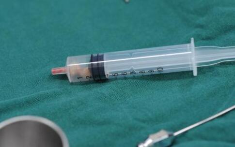 注意事項(xiàng)